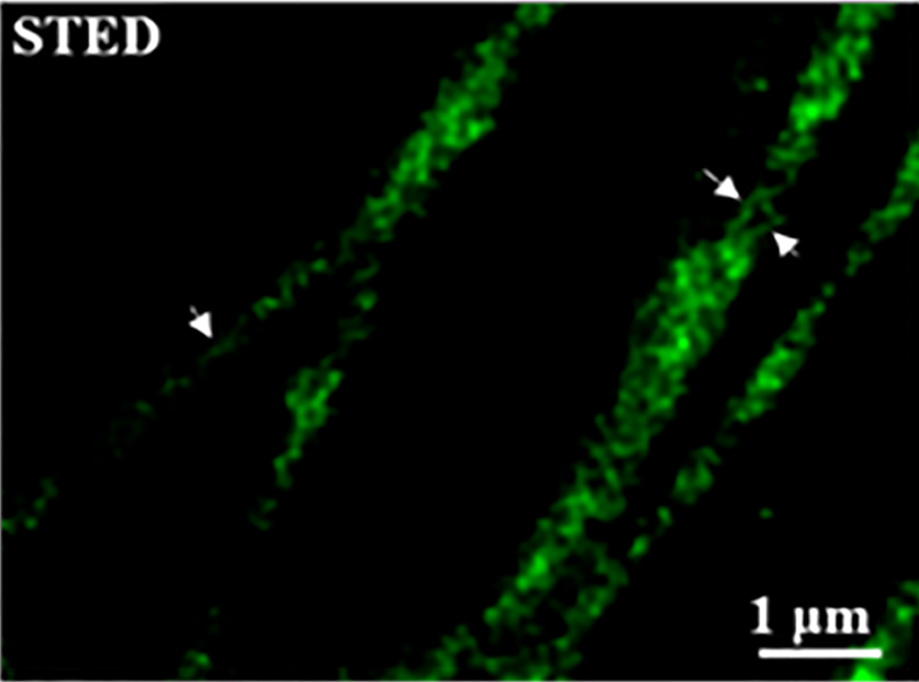 STED超分辨成像 · 微管蛋白